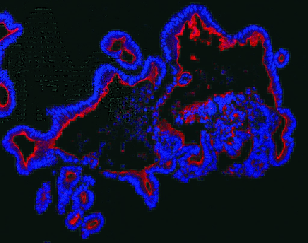 Corning Advances the Organoid Revolution