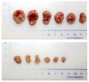 Target for Aggressive Prostate Cancer Prevention Identified in Mice