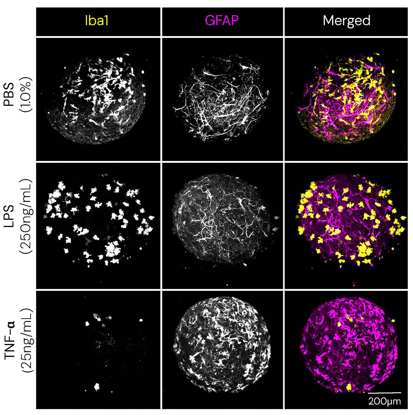 Evaluating CNS Anti-inflammatory Therapies with Human Brain Organoids