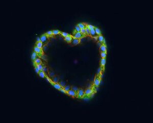 Patient-derived organoids