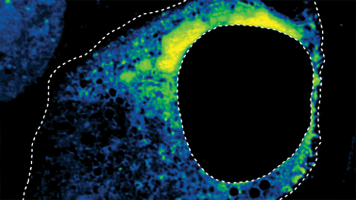 A microscope image of a cell infected with respiratory syncytial virus that has been treated with an antiviral drug. The drug causes shape changes to the viral condensates (shown in yellow), resulting in a disruption of viral replication. The large black circular structure is the cell’s nucleus. [Cliff Brangwynne]