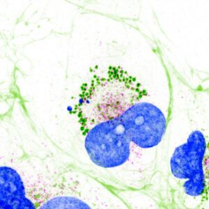 Human liver cells showing collagen droplets inside the cell (green clusters), held in place by TANGO1 (magenta), with extracellular collagen fibres visible as the surrounding network. Cell nuclei are stained blue. [Soumya Bhattacharyya / Centre for Genomic Regulation]