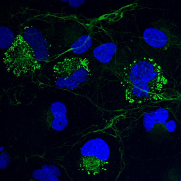 Collagen Resides Inside Cells in Liquid Condensate-Like Form