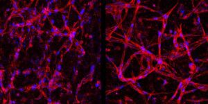 This image depicts both healthy (right) and deteriorated (left) human retinal endothelial cells, which are essential for maintaining eye sight. The deterioration is caused by low oxygen and high glucose levels, mimicking conditions found in diabetic retinopathy, the leading cause of vision loss in working-age people in the United States. [Duke University]