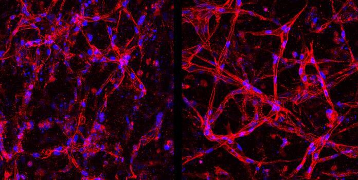 iPSC-Derived Retinal Endothelial Cells Offer Platform for Studying Diseases