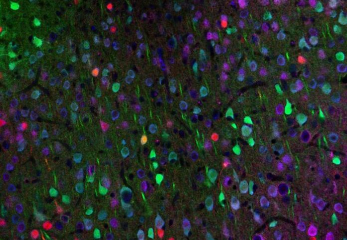 Huntington's