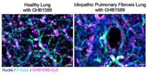 Lung Images