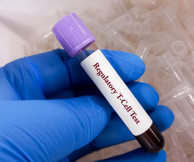 Cellares and Sonoma Biotherapeutics Agree to Automate Engineered Treg Cell Therapy Manufacturing