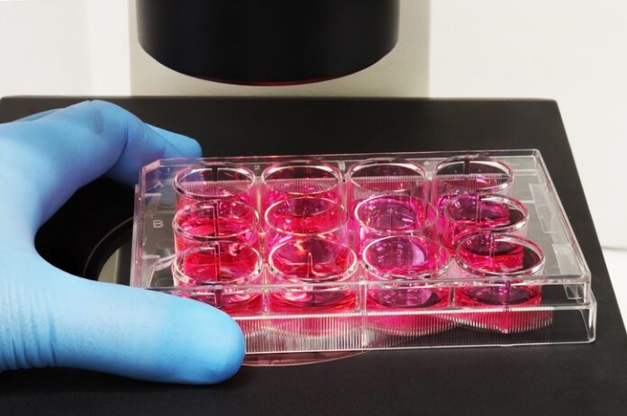 cell culture dish