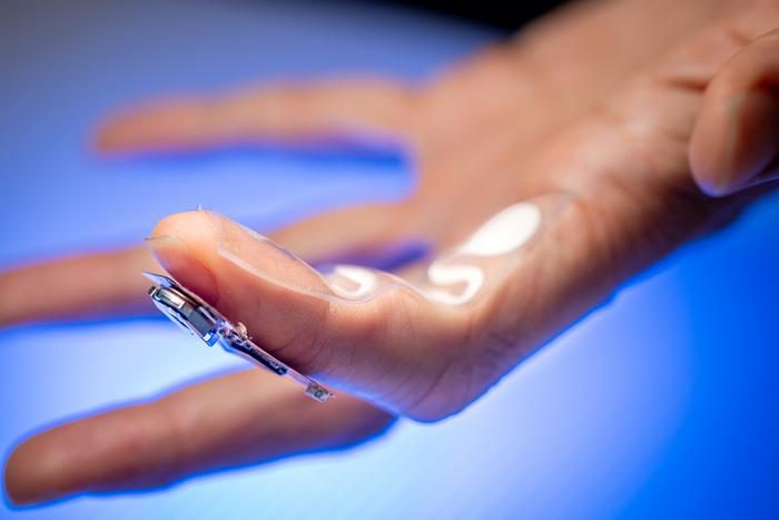 Parkinson’s Disease Medication Monitored with Fingertip Sweat Patch