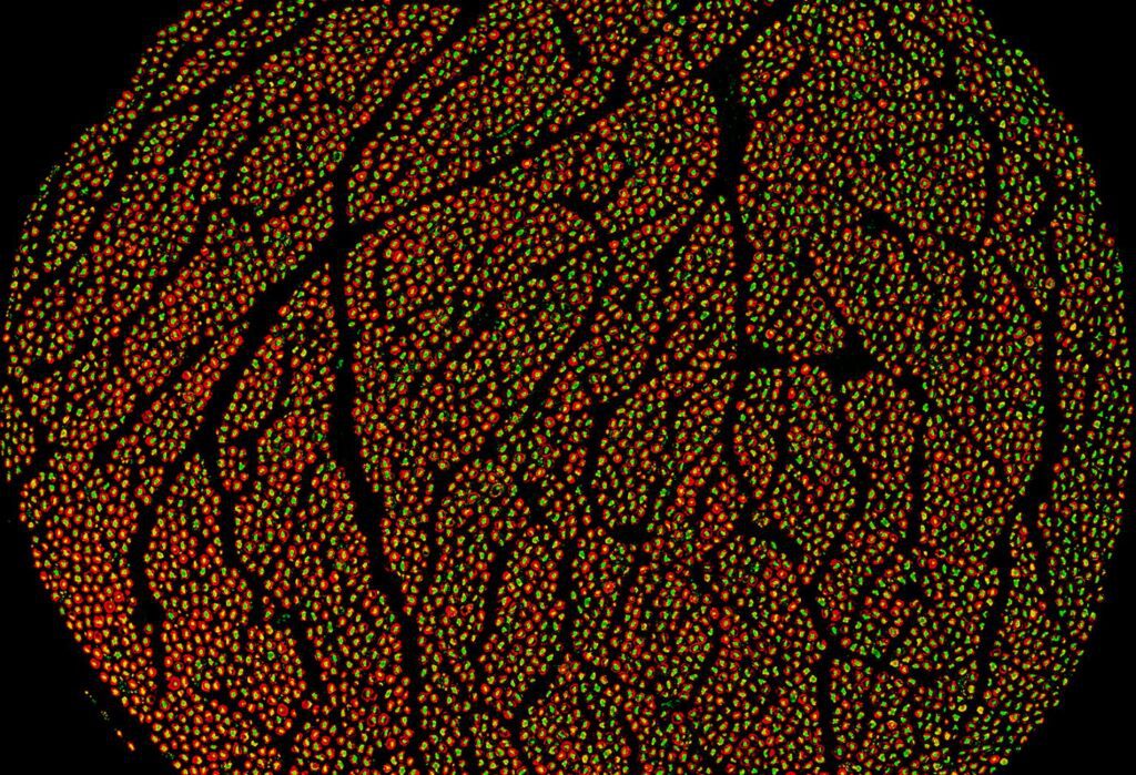 The human vagus nerve contains about 100,000 individual nerve fibers, some as small as 0.5 micrometers. Using fluorescent protein markers and high-resolution imaging, researchers can make these tiny fibers visible, show how different fiber types are organized within the nerve bundles, and begin to understand what kinds of information each group of fibers carries. [Feinstein Institutes]