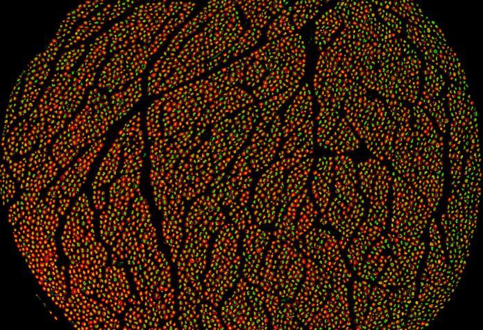 The human vagus nerve contains about 100,000 individual nerve fibers, some as small as 0.5 micrometers. Using fluorescent protein markers and high-resolution imaging, researchers can make these tiny fibers visible, show how different fiber types are organized within the nerve bundles, and begin to understand what kinds of information each group of fibers carries. [Feinstein Institutes]
