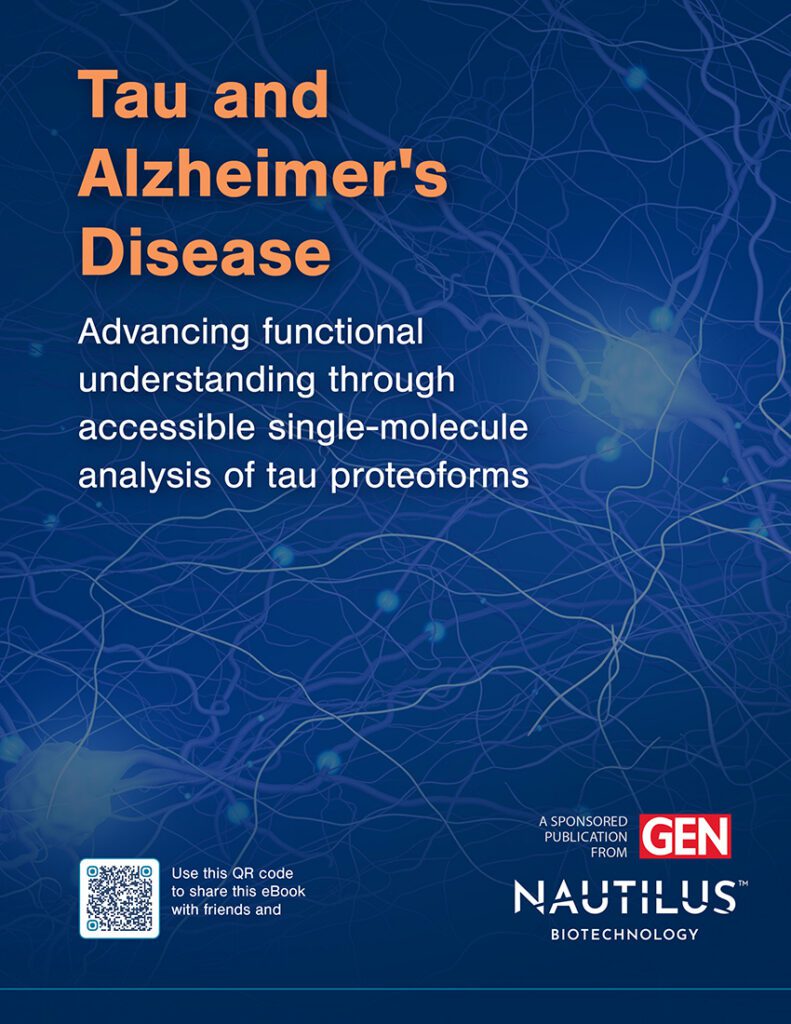 Tau and Alzheimer's Disease eBook cover