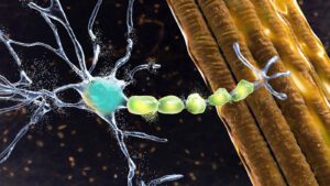 amyotrophic lateral sclerosis (ALS), antisense oligonucleotides
