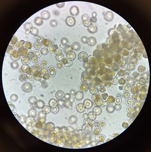 Algae-Based Food Product Development Earns Gates Foundation Award