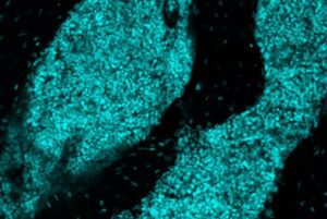 Researchers at WashU Medicine discovered lymph node-like structures (cyan) in the skull bone marrow of mice that play a role in mounting a rapid immune response in the brain. [Jang Hyun Park]