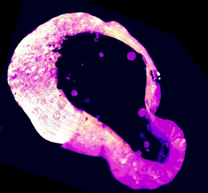 Polyamine sensor in gut organoids. [Pushkal Sharma/ Whitehead Institute]