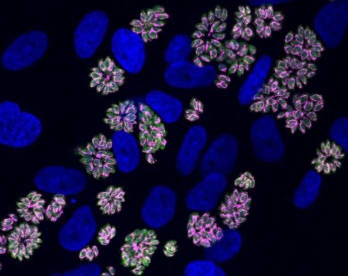Toxoplasma parasites are shown in green, with host and parasite nuclei in blue. The iron-sulfur cluster assembly protein ISCU, shown in magenta, localizes to the parasite mitochondria and highlights their structure. ISCU is one of the targets regulated by TgPRO. [Whitehead Institute/Lourido Lab]
