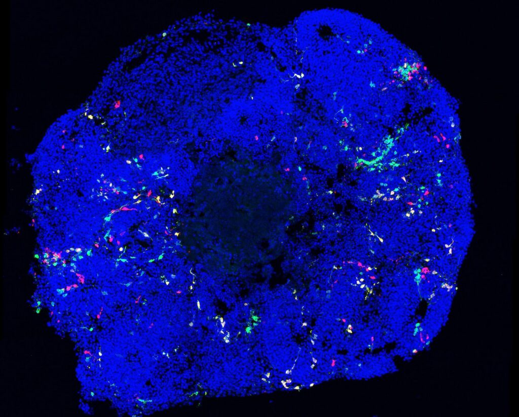 Organoid