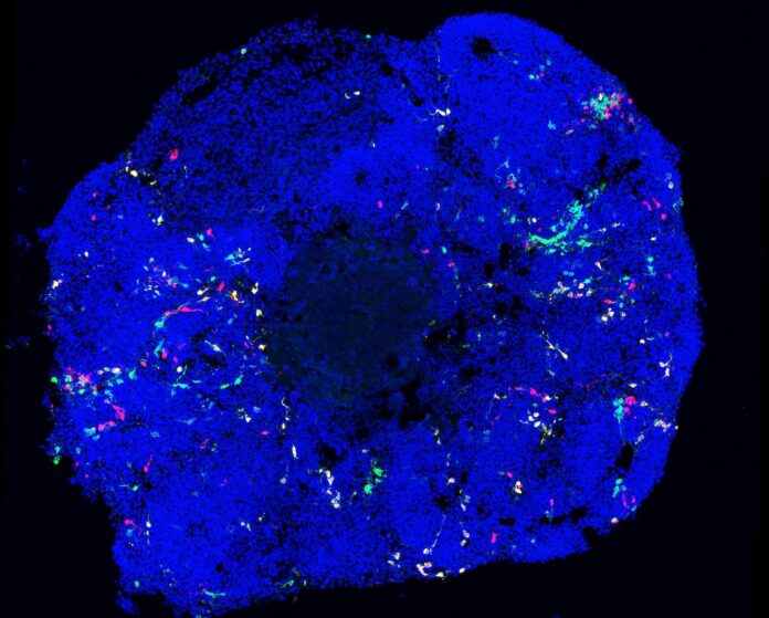 Organoid
