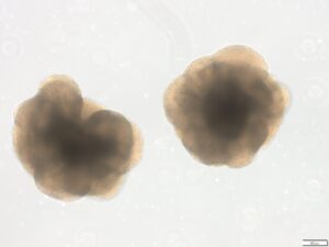 organoids