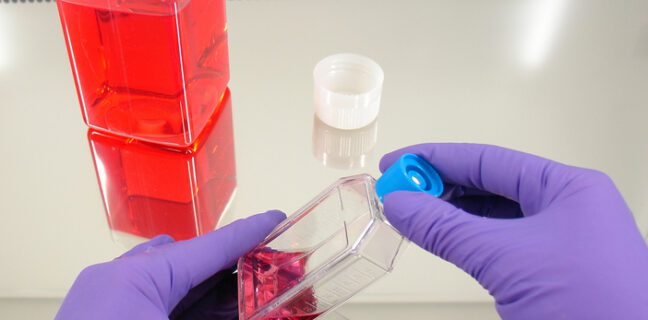 cell culture flask