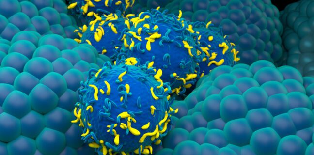 Chimeric antigen receptor (CAR) T cells (blue and yellow) being used to treat prostate cancer (light blue, nodular), illustration.