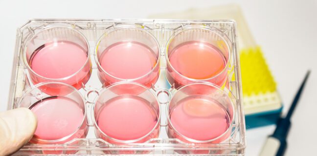 The GBI platform combines technologies from industry partners ATUM and Thomson Instrument to streamline cell line development, process scaleup, and manufacturing. [Sergunt/Getty Images]