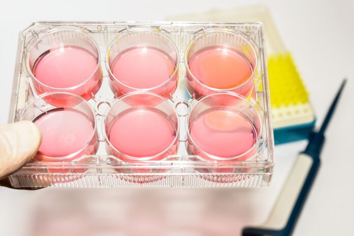 The GBI platform combines technologies from industry partners ATUM and Thomson Instrument to streamline cell line development, process scaleup, and manufacturing. [Sergunt/Getty Images]