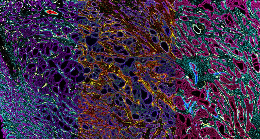 spatial tissue