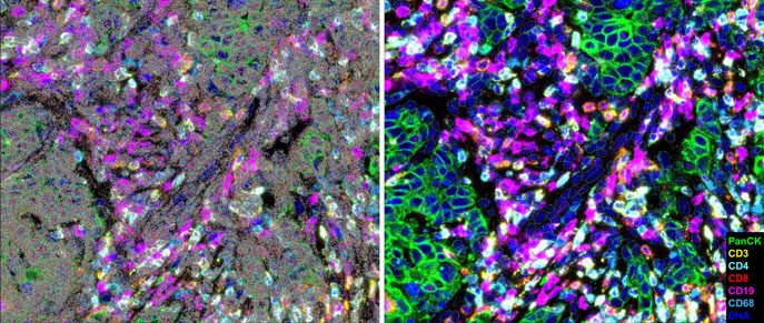 Human breast FFPE tissue
