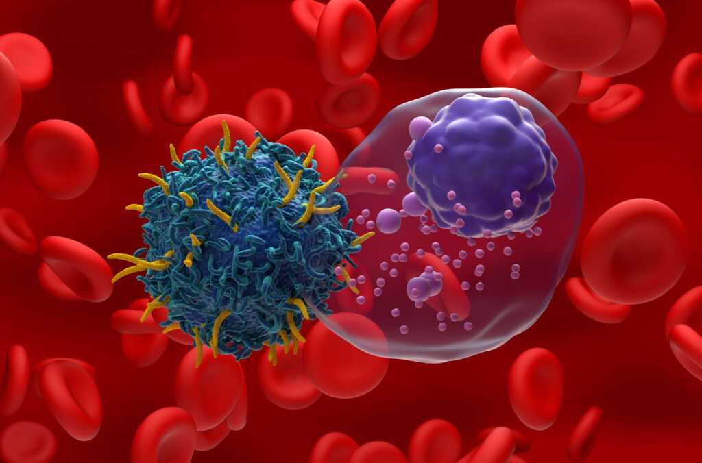 Illustration of a chimeric antigen receptor (CAR) T cell (blue) attacking a multiple myeloma cell (purple). Multiple myeloma is type of cancer, it occurs when a plasma cell becomes abnormal and cancerous. The cancerous plasma cell divides and multiplies creating large amounts of abnormal antibodies. CAR-T therapy is a type of immunotherapy that genetically modifies a patient's own T cells, a form of white blood cell, to recognise and destroy cancer cells