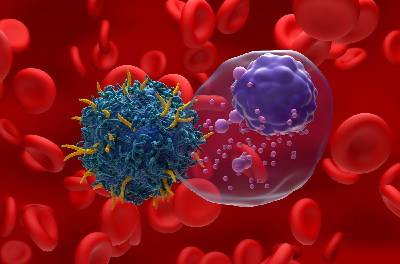 Contracting Expansion: A Path to Better CAR T-Cell Therapy Production