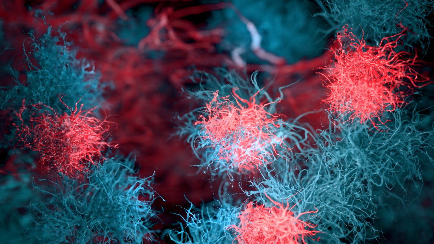 Researchers Validate Buoyant Mass for Cell Health Testing