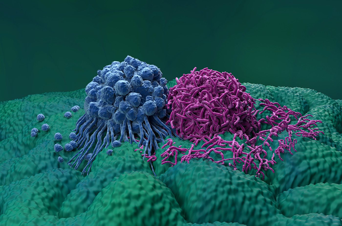 Spatial Proteomics for Precision Oncology