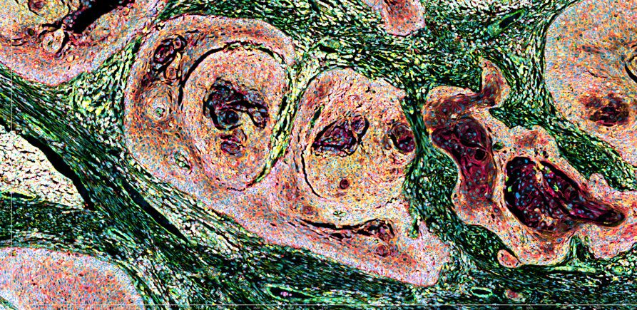Human FFPE tissue