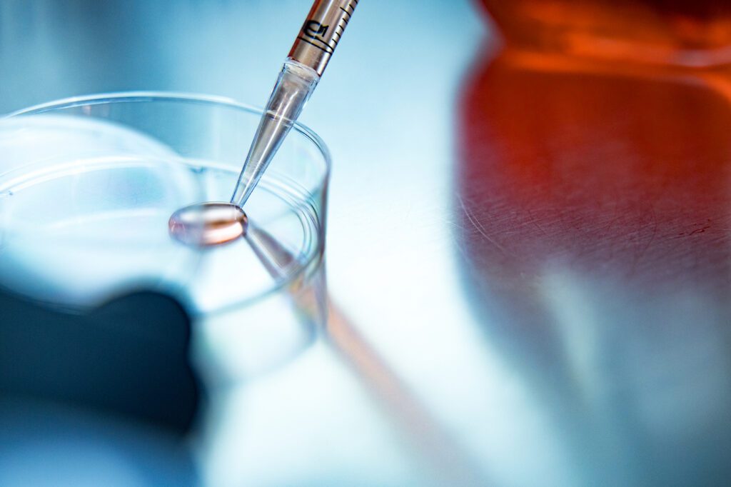 Image of a petri dish for growing micro organisms inside Immobazyme lab